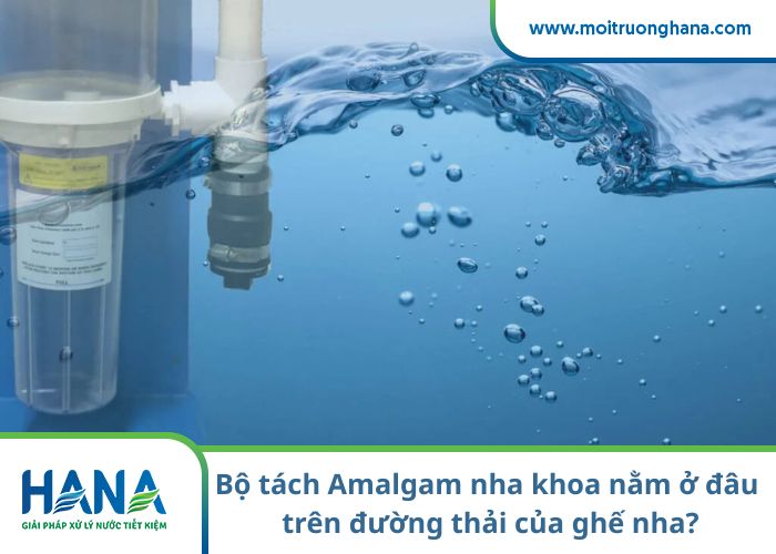 Bộ tách Amalgam nha khoa nằm ở đâu trên đường thải của ghế nha?